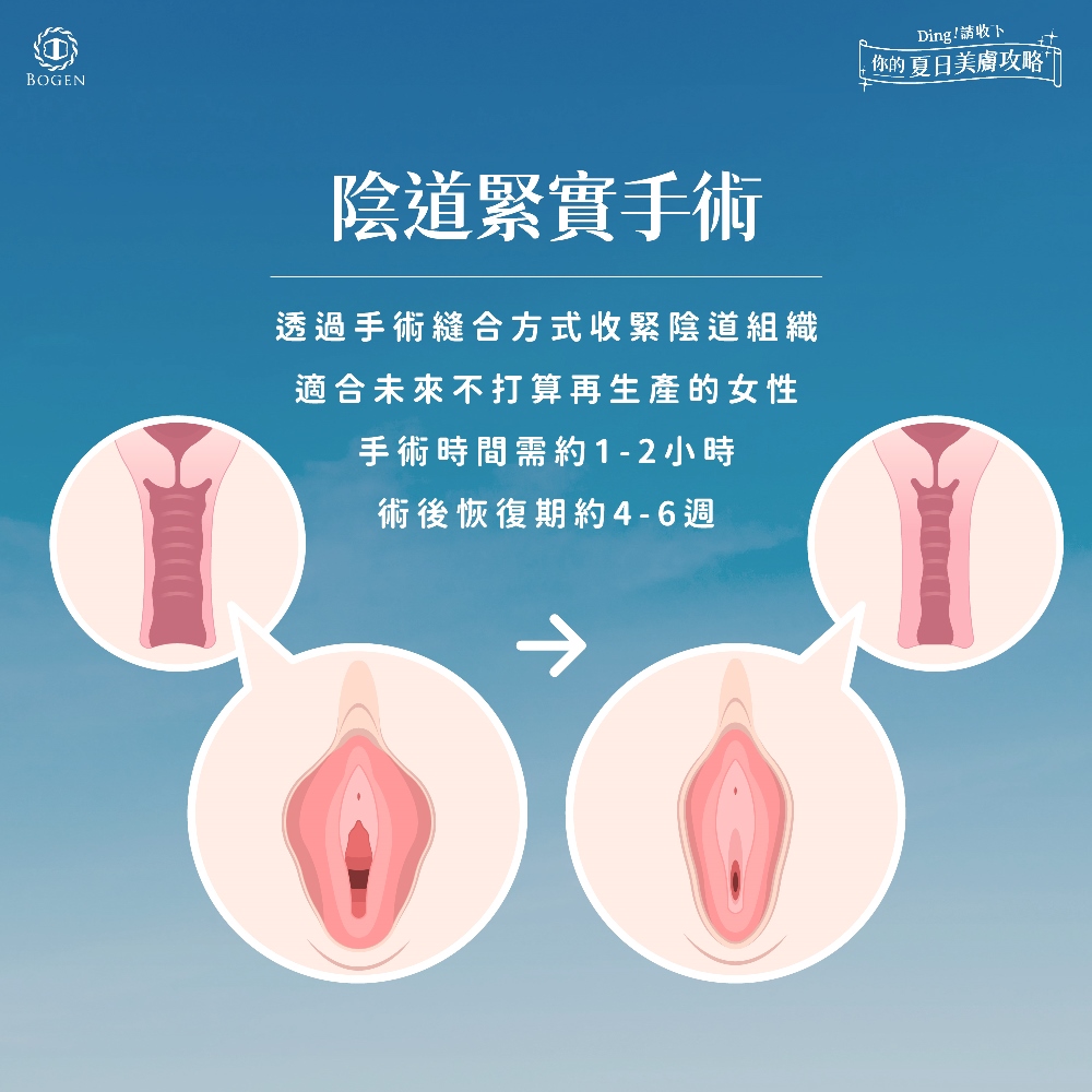 私密處手術推薦陰道緊實,推薦宋承嬡醫師,博恩妍